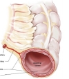 thumbnail image from paper