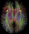 thumbnail image from paper