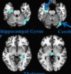 thumbnail image from paper