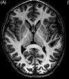 thumbnail image from paper