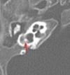 thumbnail image from paper