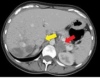 thumbnail image from paper
