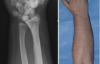 thumbnail image from paper