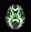 thumbnail image from paper