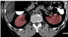 thumbnail image from paper