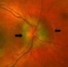 thumbnail image from paper