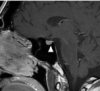 thumbnail image from paper