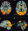 thumbnail image from paper