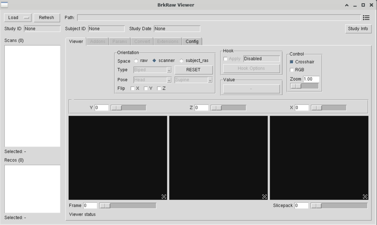 MaxQuant window